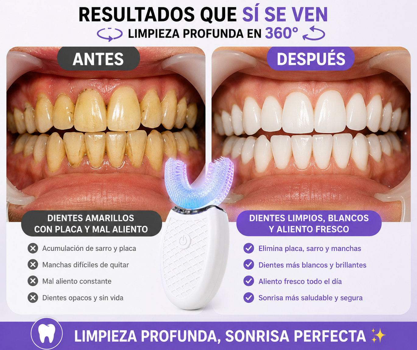 🦷CEPILLO DENTAL ELÉCTRICO 360° AUTOMÁTICO🦷